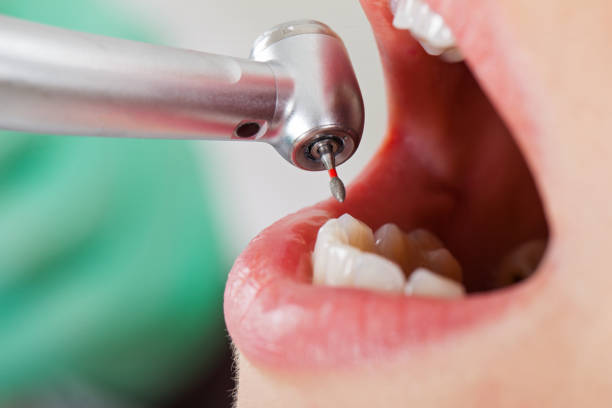 Best Emergency Tooth Extraction in Elizabethville, PA